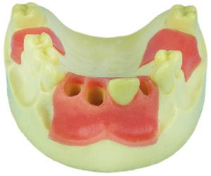 U004G-1